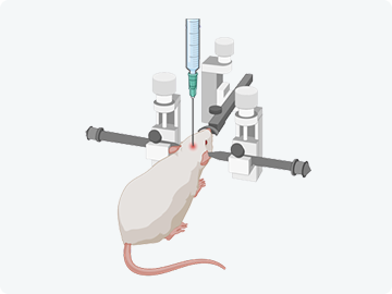 Stereotaxic Surgery 